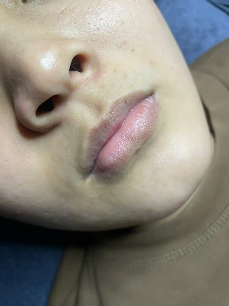 Trước khi phun môi